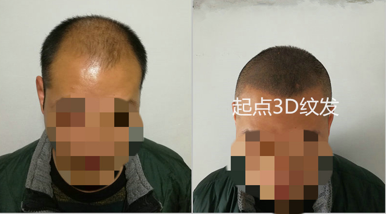 淮安起点纹发作品
