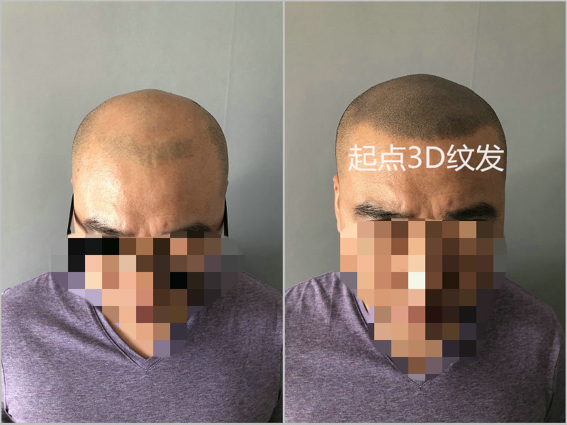 淮安纹发案例